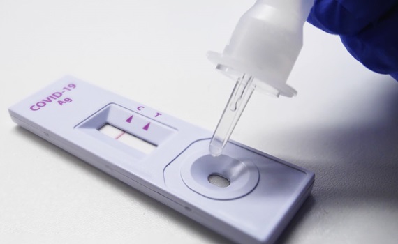 covid-19快篩 檢驗測試
